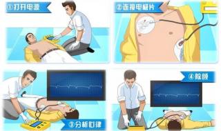 aed除颤仪多少钱一台